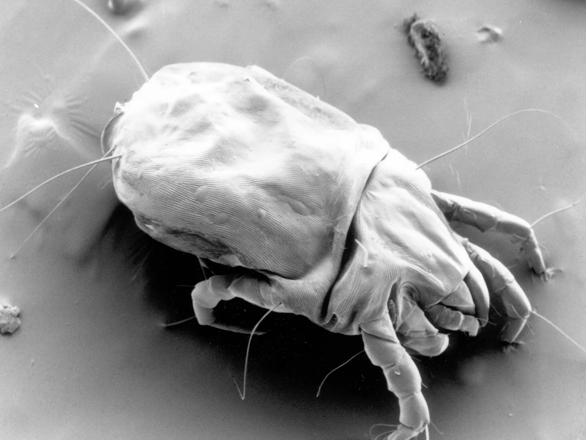 Micrografía electrónica de un ácaro del polvo doméstico, un arácnido de menos de medio milímetro que vive entre las fibras del colchón