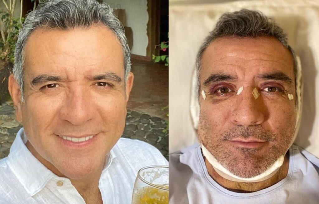 El Proceso de Recuperación de Héctor Sandarti