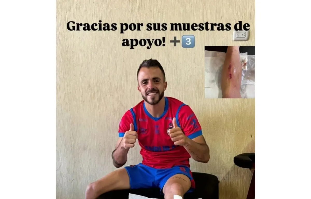 Municipal Recibe un Duro Golpe en su Debut Sebastián Bini Debe Tomar una Decisión Crucial